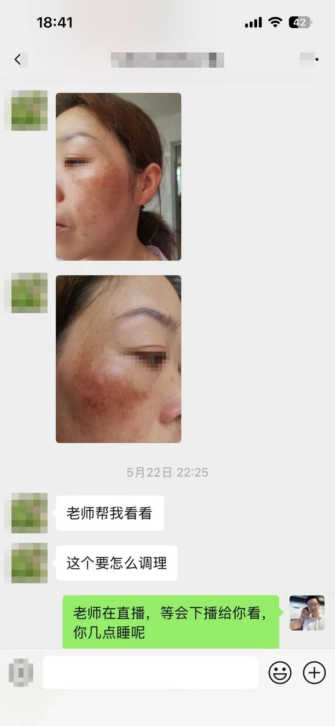 5月22日22:25 真发来三张素颜照求看