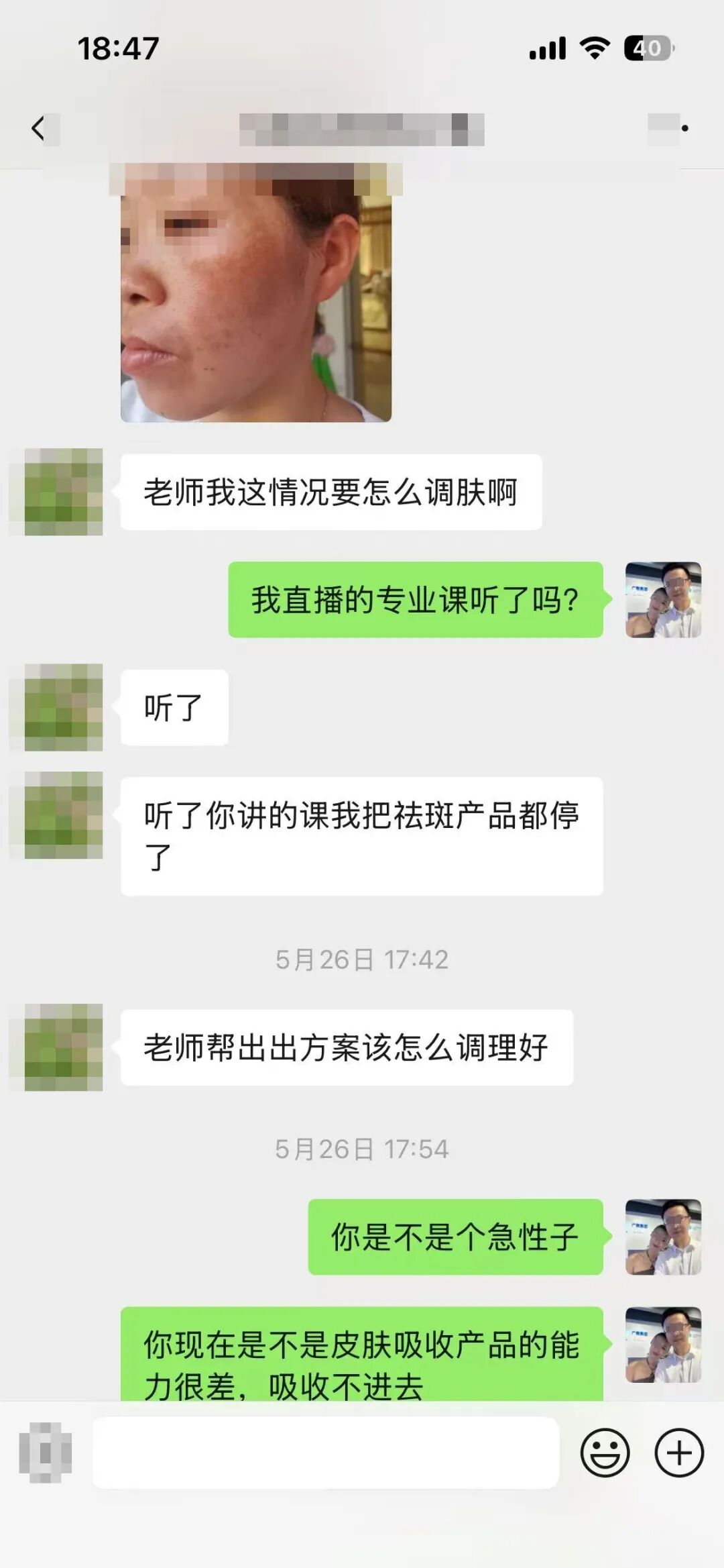 5月26日 听了你讲的课，我把淡斑产品都停了