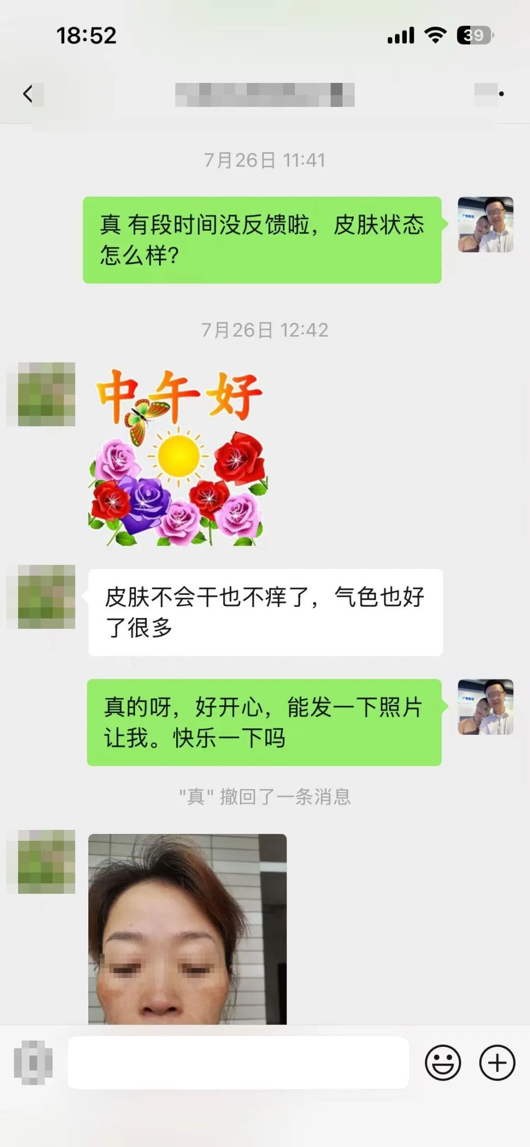 7月26日 皮肤不会干也不痒了，气色也好了很多
